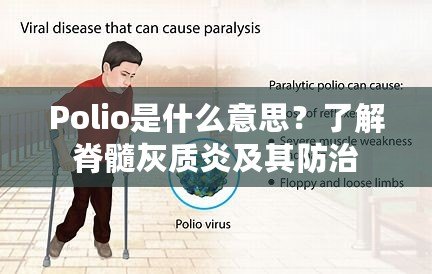 Polio是什么意思？了解脊髓灰質(zhì)炎及其防治